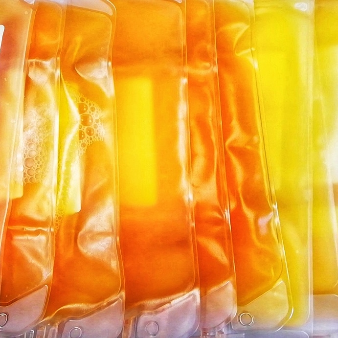 Policromia piastrinica: dove il colore non fa la differenza